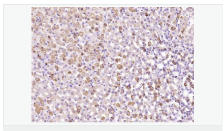 6052c102b0c36.png image.png