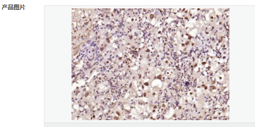 605952036b373.png image.png