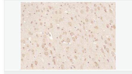 60595af1b8952.png image.png