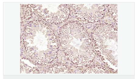 6063e43a3e537.png image.png