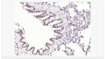 6066c3026247d.png image.png